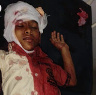 Jaunpur News स्कूली वैन खंभे से टकराकर पलटी, कई बच्चे घायल, एक की हालत नाजुक