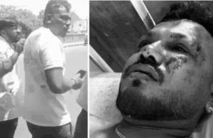 विश्वास कुमार रमेश का चमत्कारी बचाव: सीट 11A पर बैठे एकमात्र जीवित बचे यात्री ने बताई अहमदाबाद विमान हादसे की कहानी