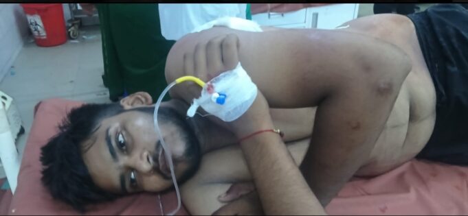 जौनपुर: दिनदहाड़े युवक पर चाकू से ताबड़तोड़ हमला, हालत नाजुक 1000942052-1